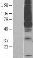 PIGM Protein (Over-Expression Lysate Myc-DDK (Flag))