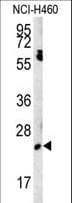 EBPL Antibody (aa177-206)