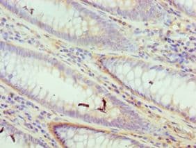 DFFA / ICAD / DFF45 Antibody (aa1-331)
