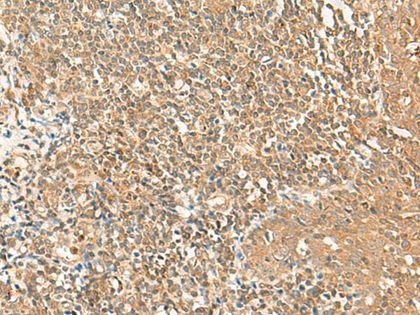 GRIPAP1 / GRASP1 Antibody