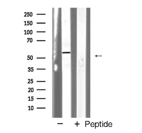 Polyclonal Rabbit anti-Human p56lck / LCK Antibody (IF, WB)