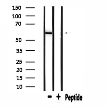 ME1 / Malate Dehydrogenase Antibody