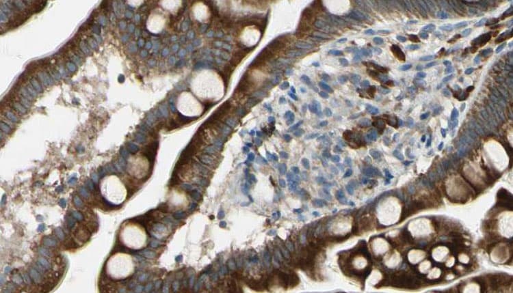 c-CBL Antibody (phospho-Tyr674)