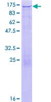 Human HK1 / Hexokinase 1 Protein (Recombinant GST)