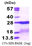 Human RPS7 / Ribosomal Protein S7 (Recombinant His)