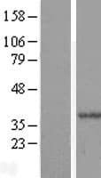 HYLS1 Protein (Over-Expression Lysate Myc-DDK (Flag))