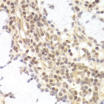 Polyclonal Rabbit anti-Human PHC1 / EDR1 Antibody (IHC, WB)