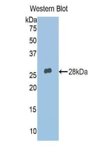 PLIN2 / ADFP / Adipophilin Antibody (aa5-232)