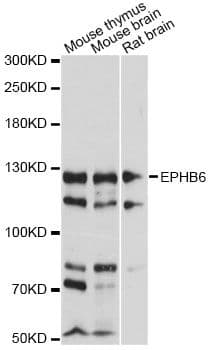 Polyclonal Rabbit anti-Human EPHB6 / EPH Receptor B6 Antibody (WB)