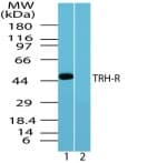 IHC-plus™ TRH Receptor / TRHR Antibody (aa350-400)