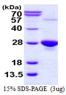 Human GPX1 / Glutathione Peroxidase Protein (Recombinant His)