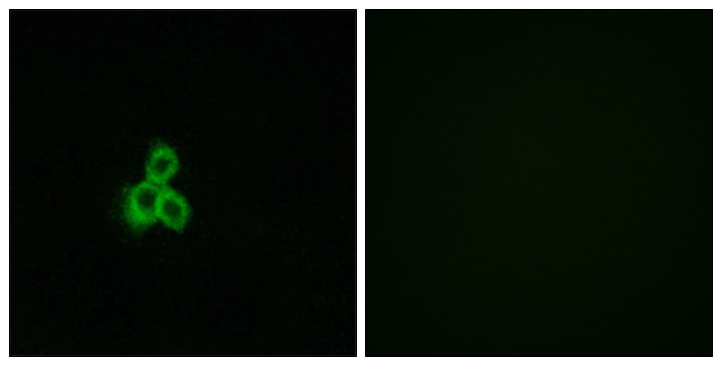 OR2T35 Antibody (aa201-250)
