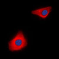 CASP10 / Caspase 10 Antibody (C-Terminus)
