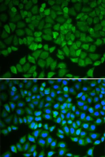 GSS / Glutathione Synthetase Antibody