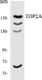 Polyclonal Rabbit anti-Human TOP2A / Topoisomerase II Alpha Antibody (aa1288-1337, WB)