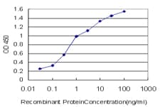 IHC-plus™ BAIAP2L1 Antibody (clone 2A4)