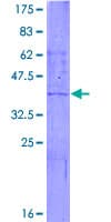 Human CYP2C9 / Cytochrome P450 2C9 Protein (Recombinant GST)