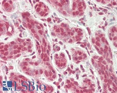 IHC-plus™ RRAGD Antibody (aa1-50)