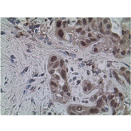 SIRT1 / Sirtuin 1 Antibody