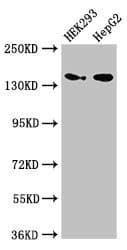 MAN2A1 / Mannosidase II Antibody