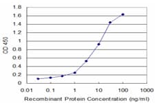 LAD1 Antibody (clone 2A9)