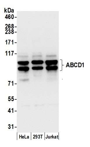 ALDP / ABCD1 Antibody (aa50-100)