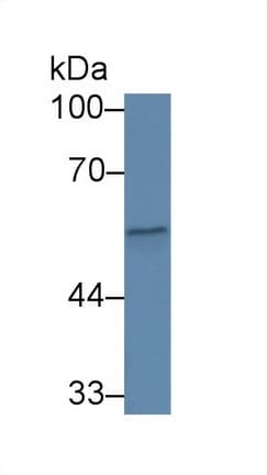 Properdin / CFP Antibody (aa65-190, PE)