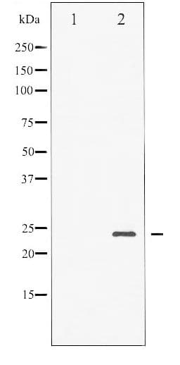 BAD Antibody (phospho-Ser136)