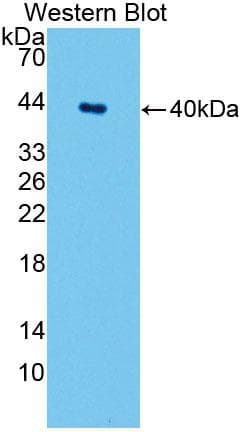 SPTLC1 / HSN1 Antibody (aa143-473, FITC)