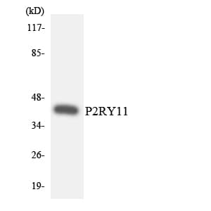 IHC-plus™ P2RY11 / P2Y11 Antibody (aa130-179)