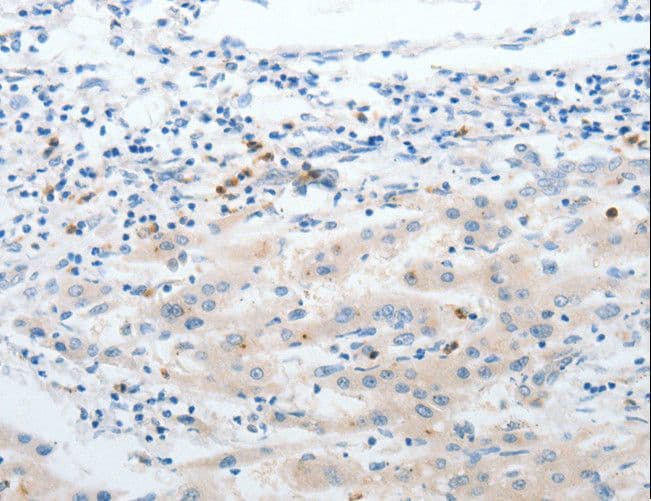 Polyclonal Rabbit anti-Human LCN2 / Lipocalin 2 / NGAL Antibody (IHC)