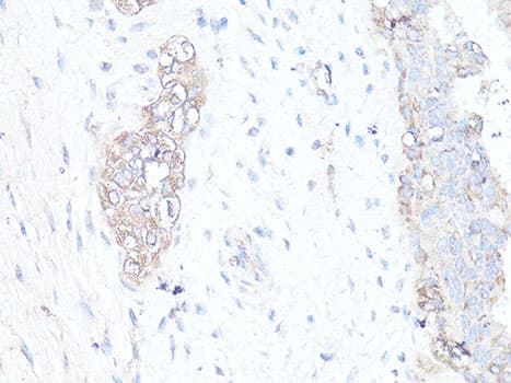 Polyclonal Rabbit anti-Human MAP1LC3B / LC3B Antibody (IHC, IF, WB)