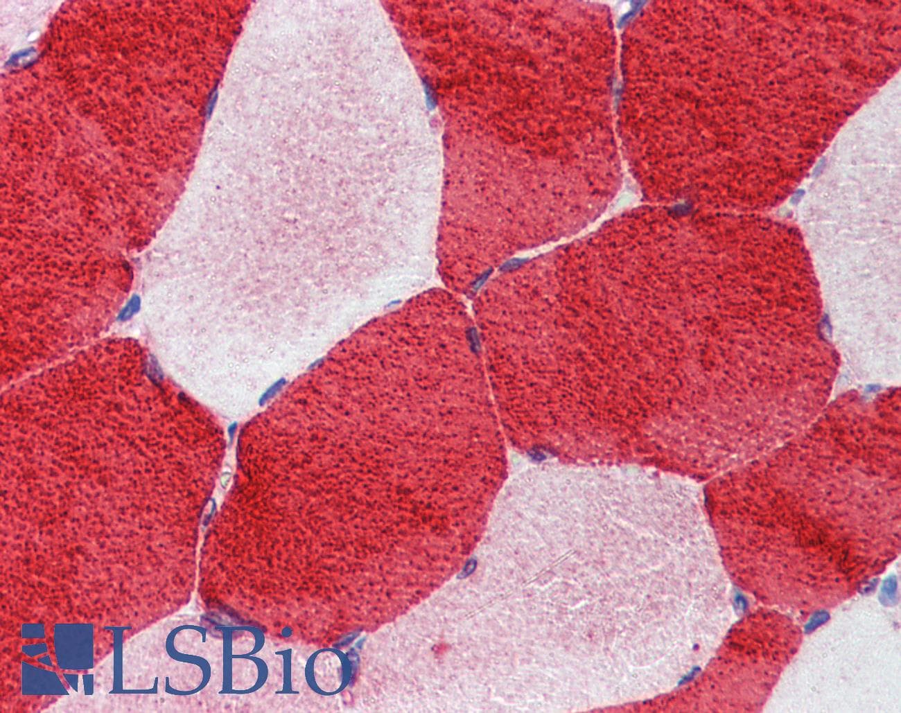TNNI1 Antibody (N-Terminus)