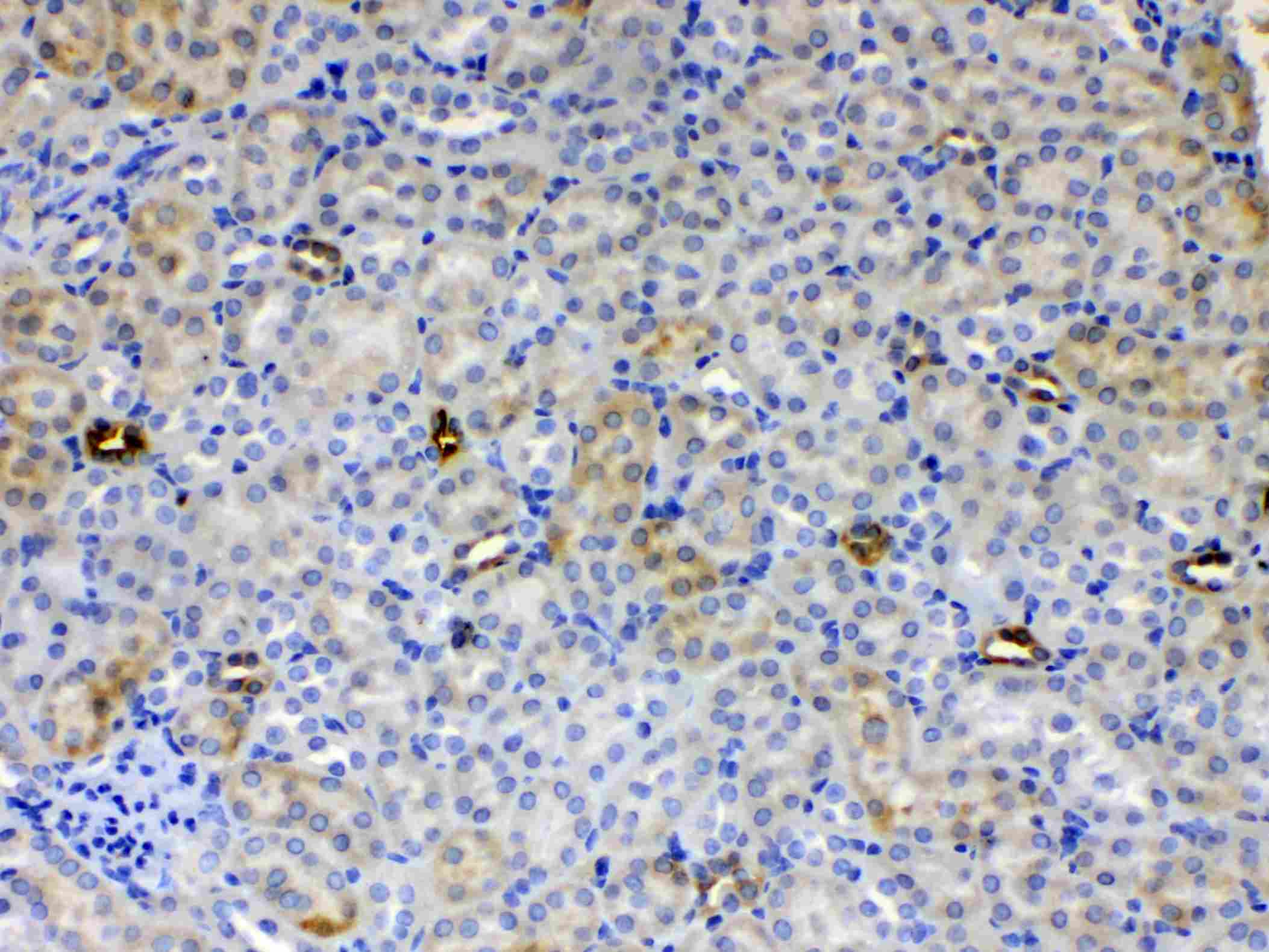 ALDH1A3 Antibody