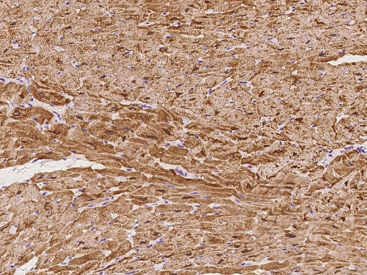 CSRP3 Antibody