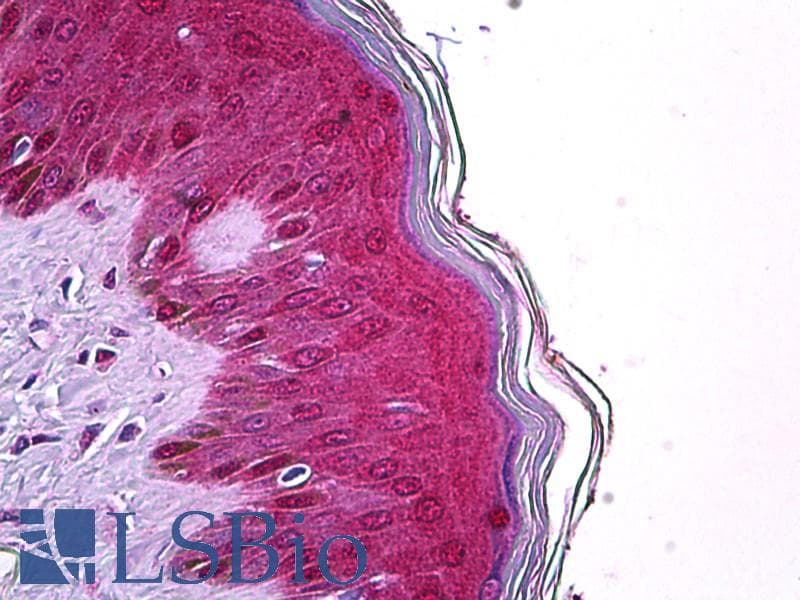 IHC-plus™ TRIM29 Antibody (aa295-306)
