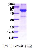 Human AHSG / Fetuin A Protein (Recombinant His)
