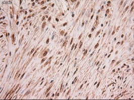 MYC / c-Myc Antibody (clone OTI3F2)
