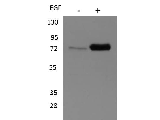 RPS6KA1 / RSK1 Antibody (C-Terminus)