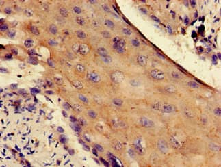 RPS4X + RPS4Y1 + RPS Antibody