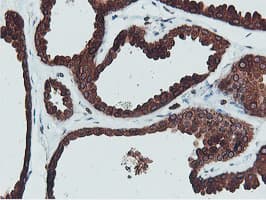APMAP / C20orf3 Antibody (clone OTI1D7)