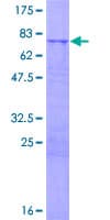 Human MRPS5 Protein (Recombinant GST)