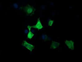Monoclonal Mouse anti-Human MAP2K3 / MEK3 / MKK3 Antibody (clone OTI1B5, IHC, IF, WB)
