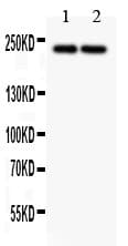 Polyclonal Rabbit anti-Human DICER1 / Dicer Antibody (aa1-195, IHC, WB)