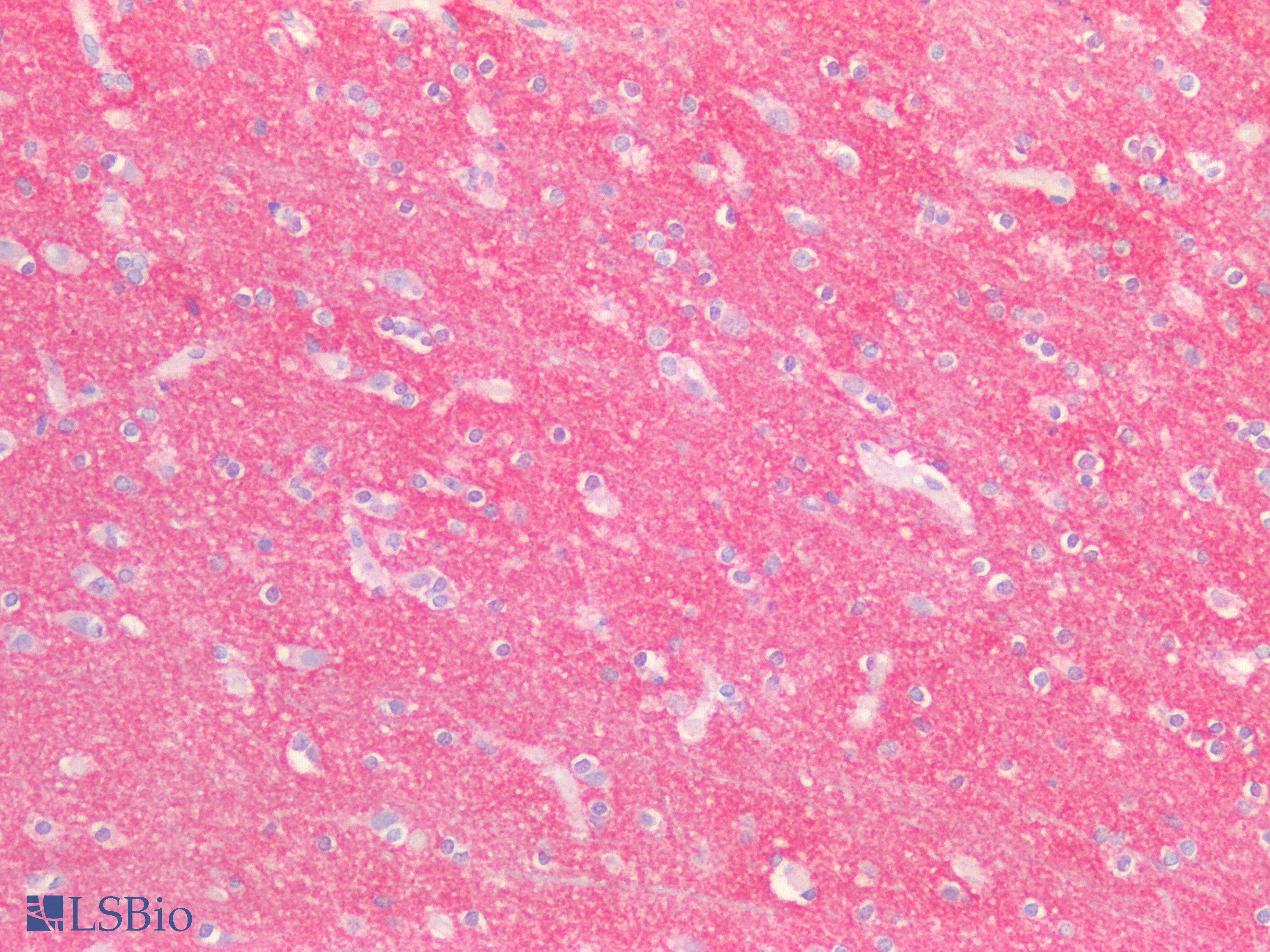 IHC-plus™ ABCB4 / MDR3 Antibody (Concentrated)