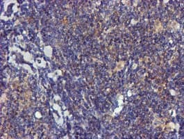 FGFR2 / FGF Receptor 2 Antibody (clone OTI3F8)