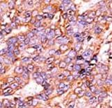 HIST1H3A Antibody (phospho-Ser10)
