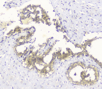 HAS1 / HAS Antibody