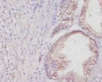 Polyclonal Rabbit anti-Rat COL1A1 / Collagen I Alpha 1 Antibody (IHC)