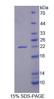 Human PLA2G12A Protein (Recombinant)